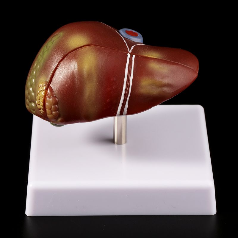 معدات مختبر نموذج تشريحي باثول - مراجعة Medical Lab Technology وسعره