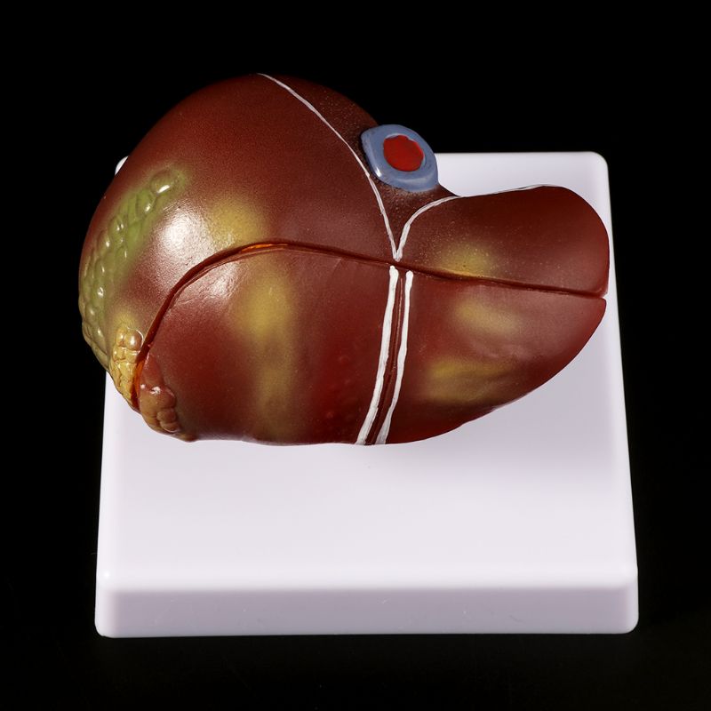 معدات مختبر نموذج تشريحي باثول - مراجعة Medical Lab Technology وسعره